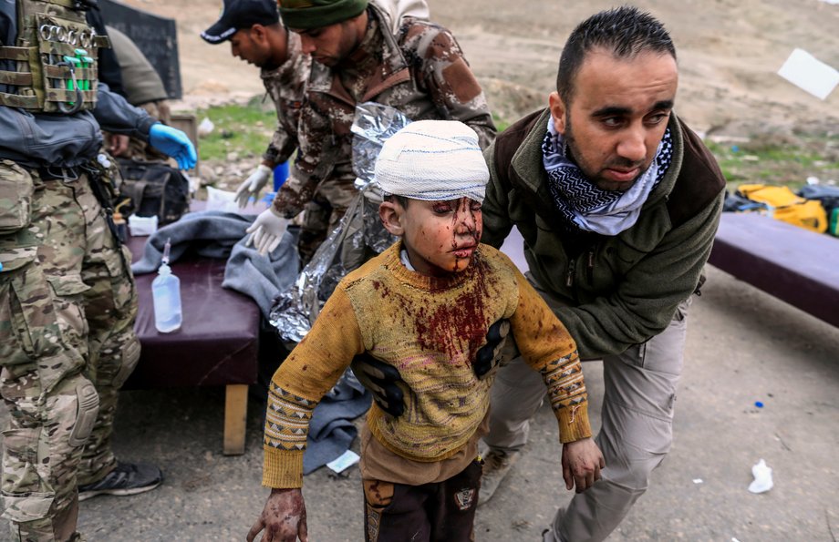 A boy injured in a mortar attack walks toward an ambulance after being treated by medics in a field clinic as Iraqi forces battle with ISIS militants, in western Mosul.