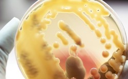 Superbakteria New Delhi - jakie choroby wywołuje?