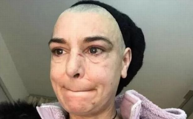 Sinéad O'Connor pobita przez syna? "Była przy tym jego dziewczyna, pomagała mu i śmiała się"