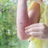 Komarci piju ljudsku krv jer im je potreban protein, vitalni gradivni blok za njihova jaja