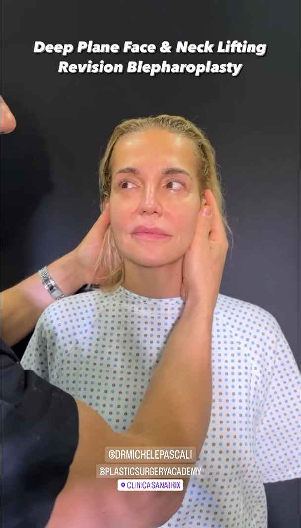 Dara Rolins na konzultačnom videu u talianskeho plastického chirurga.