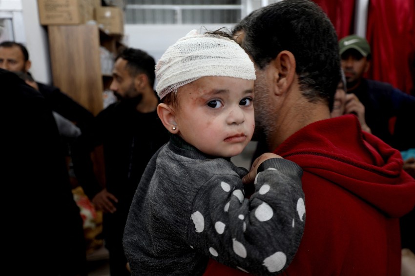 Među povređenima u današnjem izraelskom napadu ima i dece