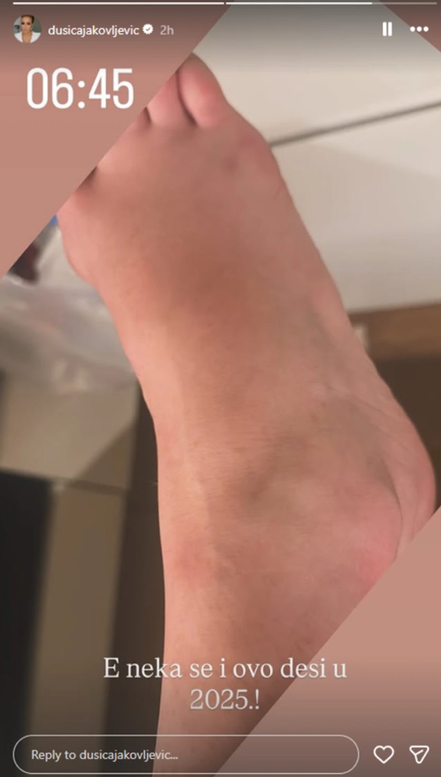 Dušica Jakovljević povredila nogu