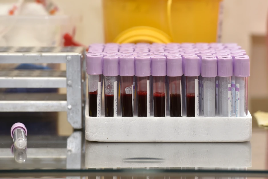 Pre doniranja trombocita i matičnih ćelija, potrebno je dati uzorak krvi