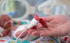 Neonatolodzy: dla wcześniaków wirus RS groźniejszy niż koronawirus
