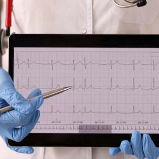 Mi az EKG és mit mutat ki?