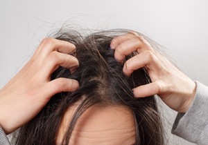 Kraste na temenu mogu biti posledica niza dermatoloških stanja