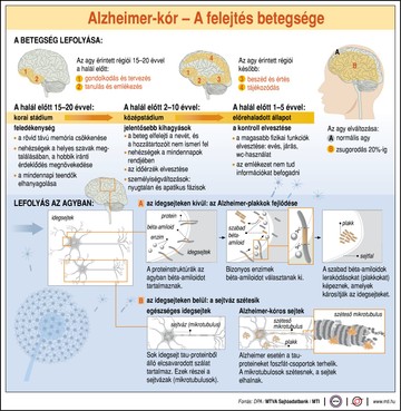 Alzheimer, memória