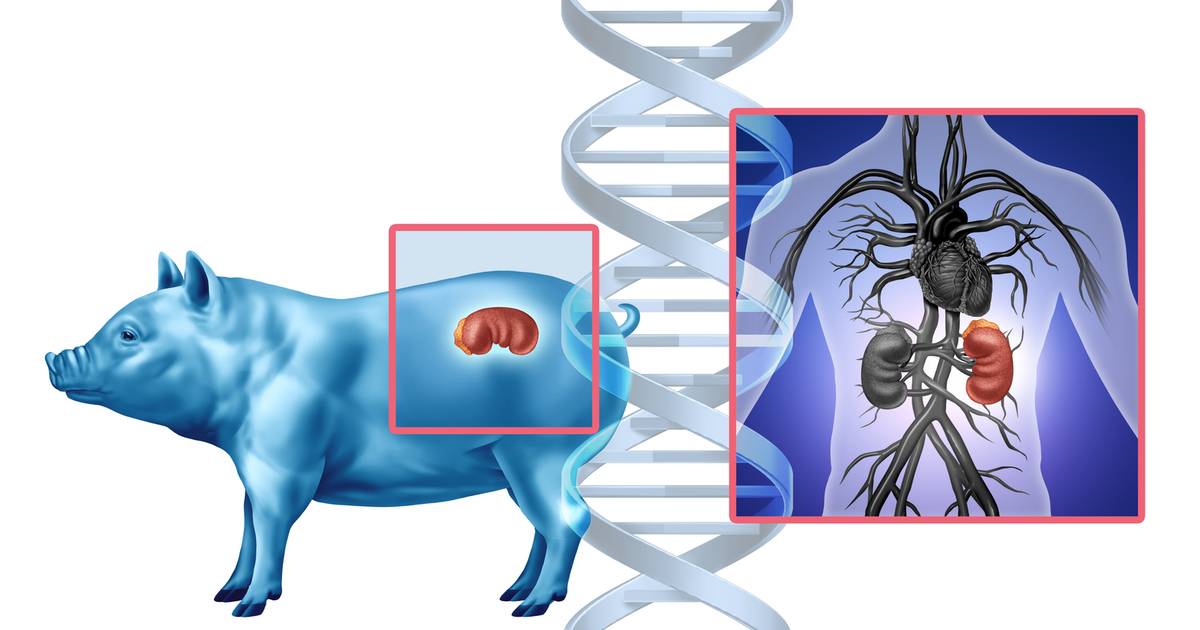 Świńskie nerki ratują życie. "Czuję się dobrze"
