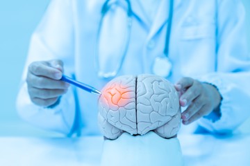 Iszkémiás stroke esetében, amennyiben a beteg állapota lehetővé teszi, és a stroke jelentkezése óta nem telt el 3 óránál több, a stroke-centrumokban sor kerülhet gyógyszeres thrombolízisre, vagyis a thromboembólus kémiai feloldására, és ezzel az elzáródott ér megnyitására.
