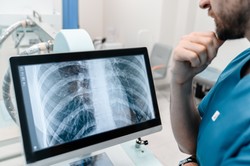 Gruźlica w krakowskim liceum. Ponad 100 osób znalazło się pod nadzorem epidemiologicznym