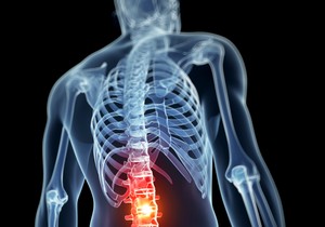 Vrste raka koje izazivaju bol u donjem delu leđa