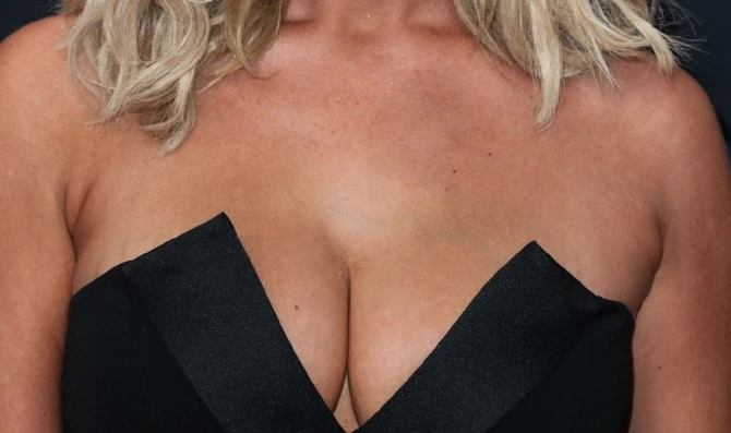 Status o plaćenim silikonima bivšoj devojci izazvao je urnebesne reakcije na mrežama (Ilustracija)