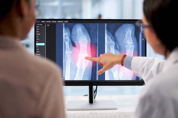 Besplatan DEXA pregled za sve Nišlije: Otvorena vrata Doma zdravlja za rano otkrivanje tihe bolesti kostiju