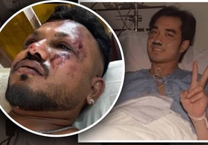 Preživeli avionsku nesreću