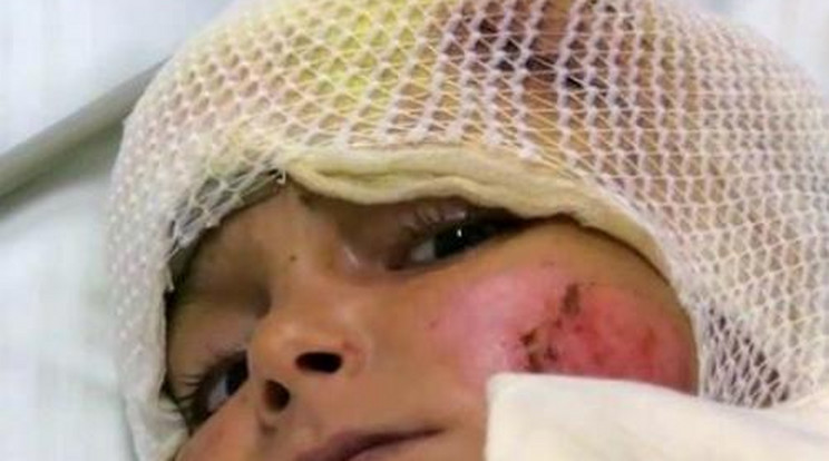 Nem bombától sérült meg a szír kisfiú!