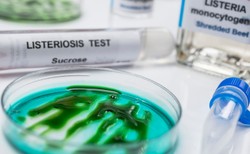 W tym roku niemal podwoiła się liczba zachorowań na LISTERIOZĘ