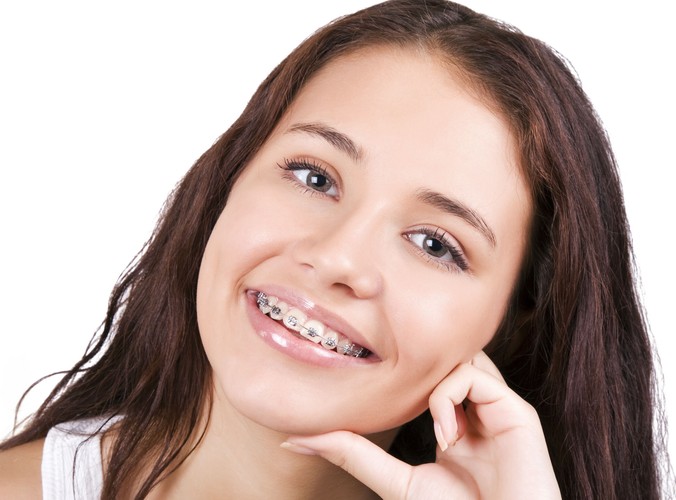 Czy muszę usuwać zdrowe zęby przed założeniem aparatu?