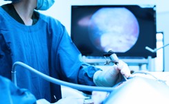 Wykonujemy za mało zabiegów laparoskopowych. Dlaczego?