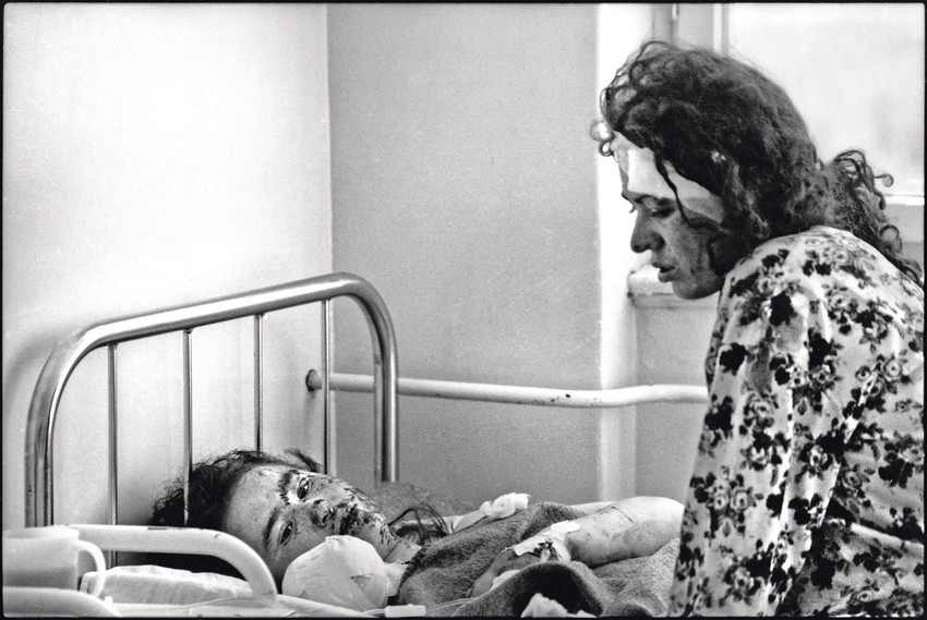 Albanske žene u bolnici pošto je NATO pogodio njihovu izbegličku kolonu