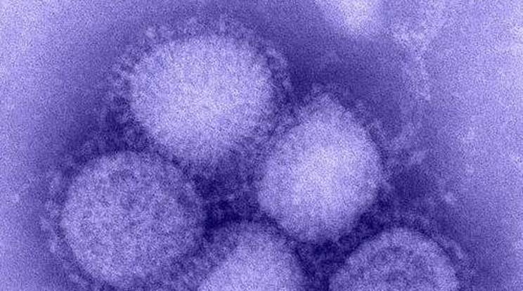 Meghalt a H1N1-es magyar beteg