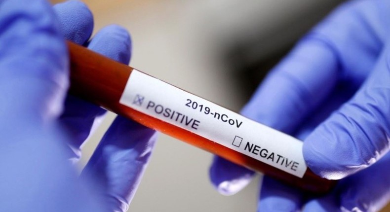 Laboratory technician holds up a Covid-19 positive sample in a vial (Reuters)