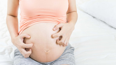 Wysypka po porodzie. Jak złagodzić jej objawy?