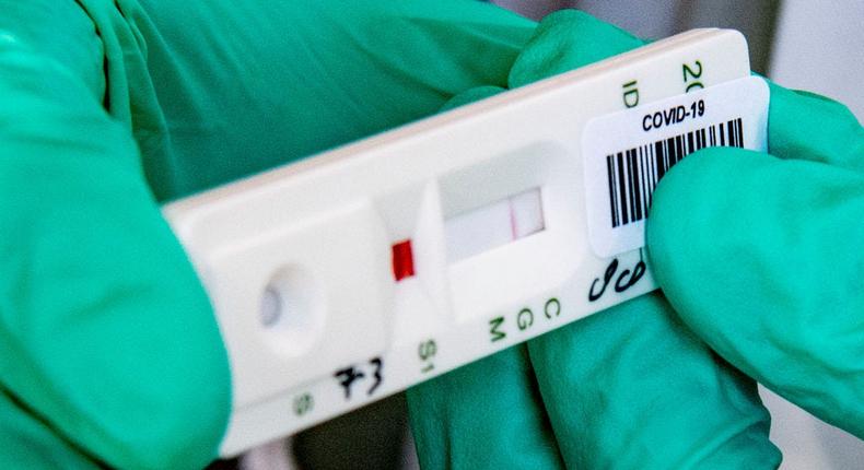 A strip running a coronavirus antibody test on a blood samples.
