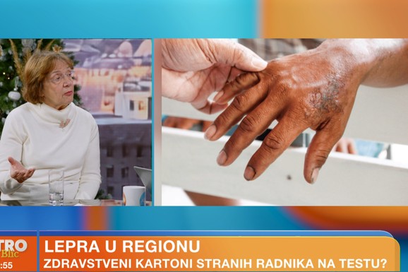 (VIDEO) "Čovek na pregledu treba da se SKINE, da mu se vidi koža... IMA RAZNIH BOLESTI koje mi nemamo ovde, koje ne vidimo": Doktorka o slučaju gube koji je uznemirio region