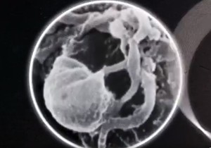 virus