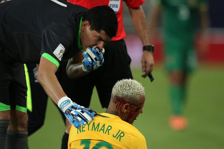 Neymar dostał z 'łokcia' i zalał się krwią. Gwiazdor musiał opuścić boisko