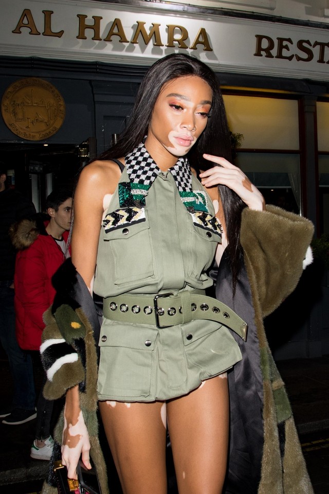 Winnie Harlow