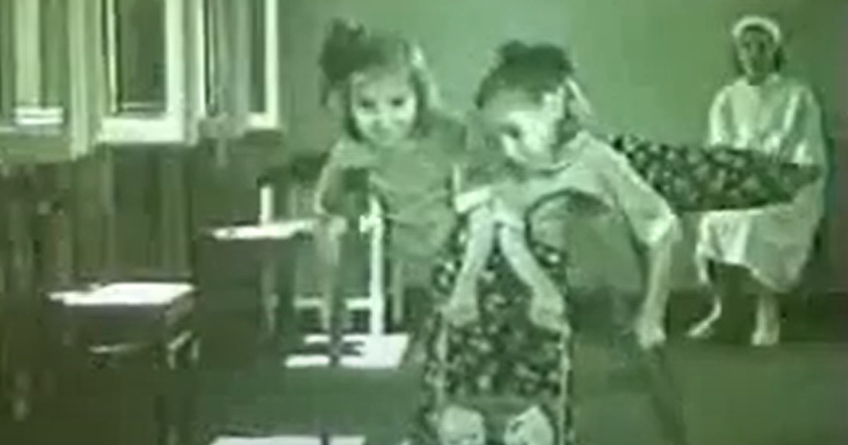Tragiczny los syjamskich sióstr w Związku Radzieckim. Lekarze zgotowali im piekło