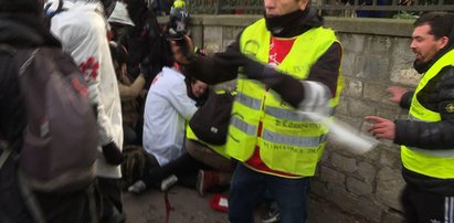 Groza w Paryżu. Jeden z demonstrantów... stracił rękę