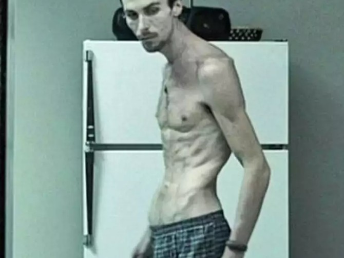 Kristijan Bejl postao živ kostur zbog uloge: Imao je samo 50 kg, jeo 200 kalorija na dan