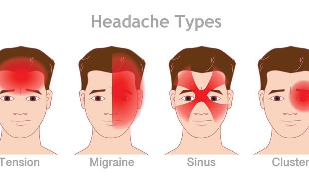 Vrste glavobolje u odnosu na mesto bola 