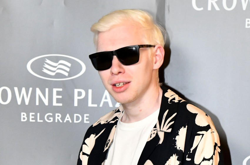 Albino