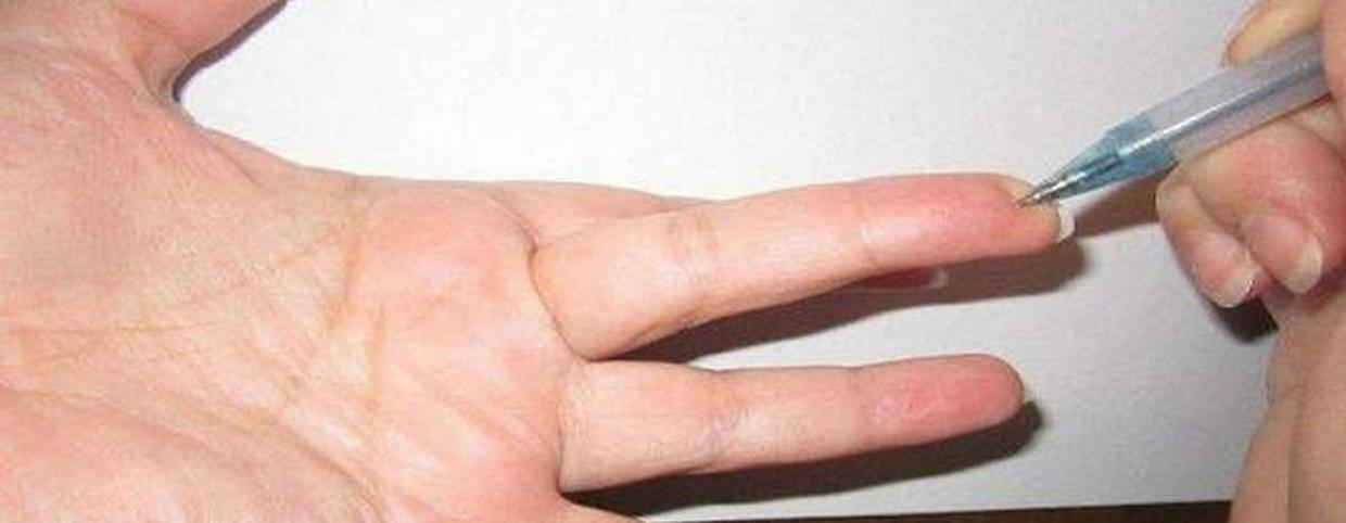 gyakorlatok a magas vérnyomásban szenvedő kezek számára