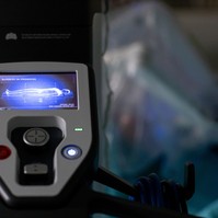 Semmelweis Egyetem: mostantól robottechnikával is műtenek nőgyógyászati daganatokat