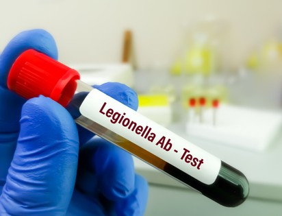 Legionárius betegség, legionellosis