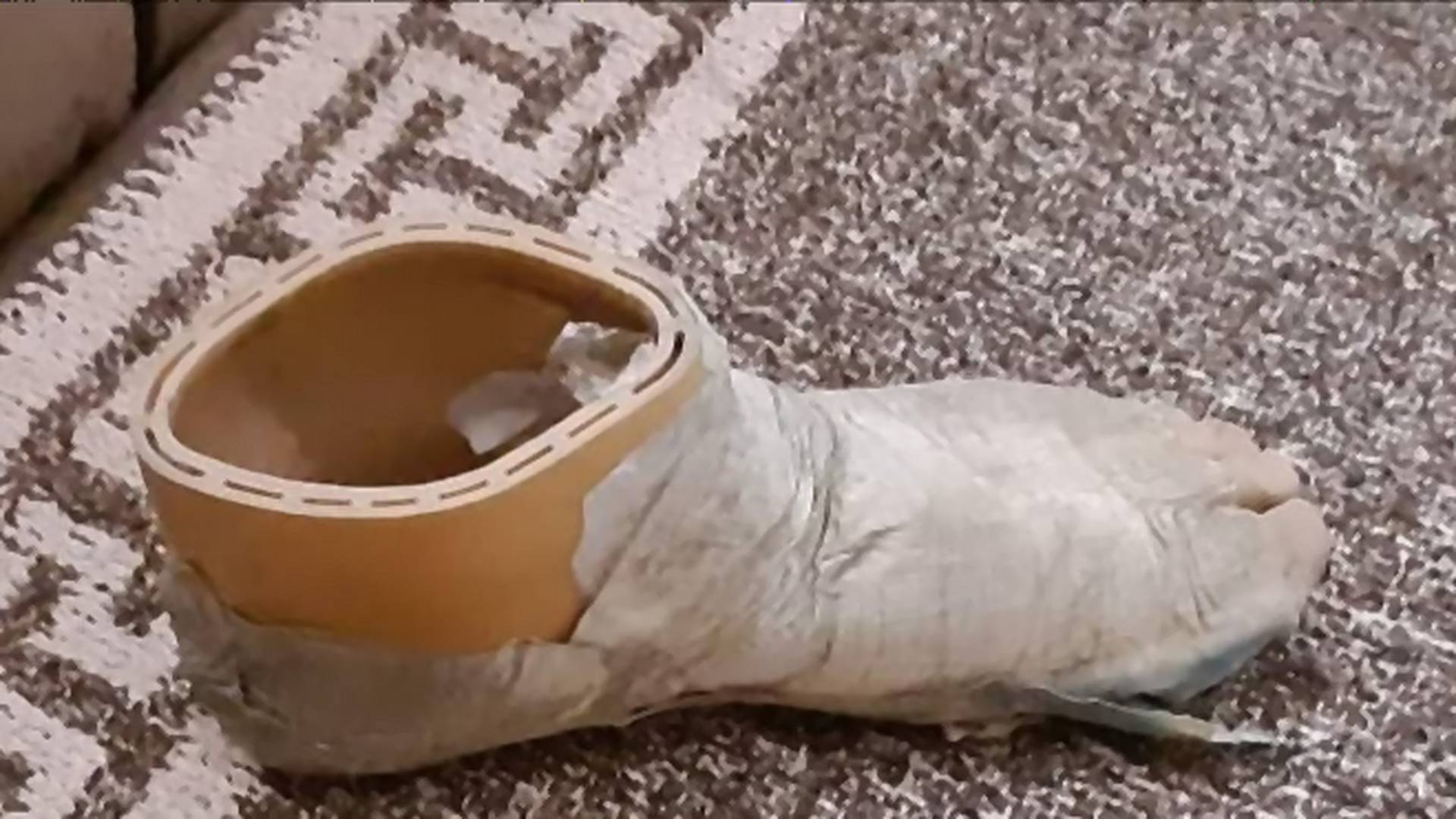 Ratni invalid iz Srbije je 7 godina nosio raspadnutu protezu za stopalo: veteran iz Hrvatske mu je pomogao i ostavio sve bez reči