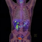highpetct-d00000176e46abe94643e