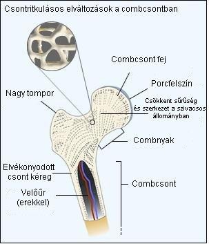 osteoporbone-d000002F5d787a8400fac