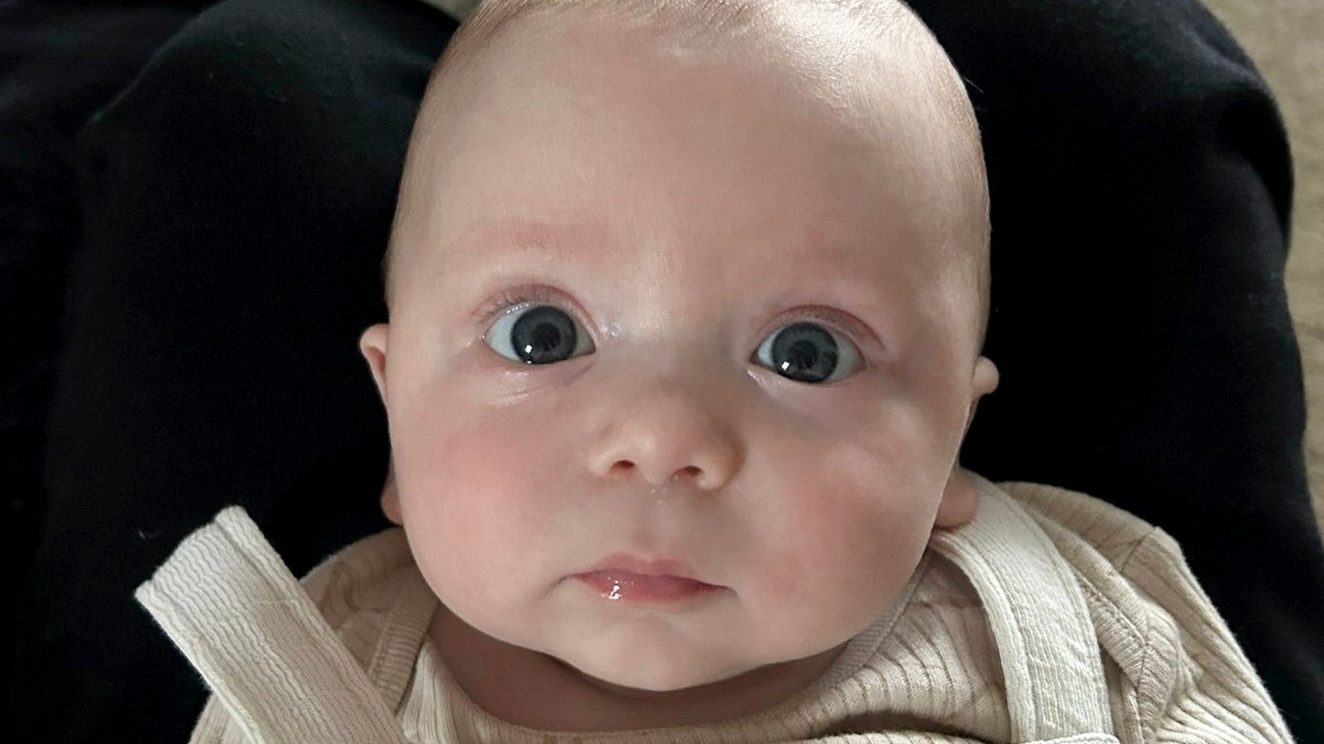 Stav malého Otta sa postupne zhoršuje.