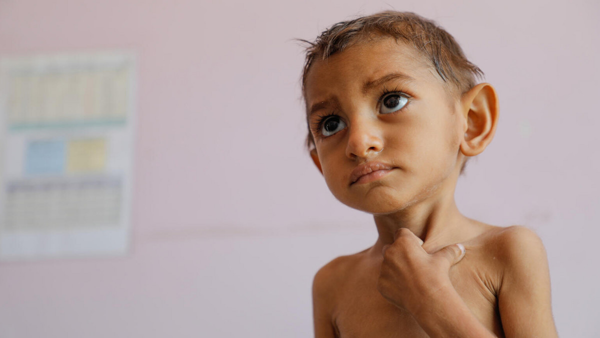 Katastrofa w Jemenie. "Codziennie widzę umierające dziecko" [WYWIAD]
