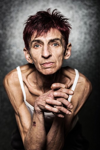 Grand Press Photo 2016 / Mateusz Skwarczek, „Gazeta Wyborcza Kraków”