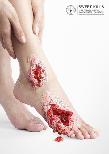 'SŁODYCZ ZABIJA'. KAMPANIA PRZECIWKO CUKRZYCY