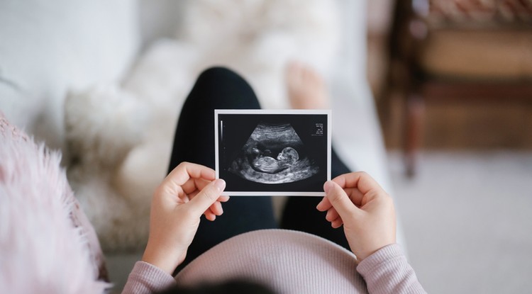 Szaniszló Kitti elárulta, hogy mikor jöhet a baba Fotó: Getty Images