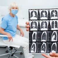 Tüdőfibrózis: szeptember a ritka tüdőbetegségek hónapja