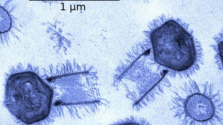 Tupanvirus, jeden z tzw. wirusów gigantów